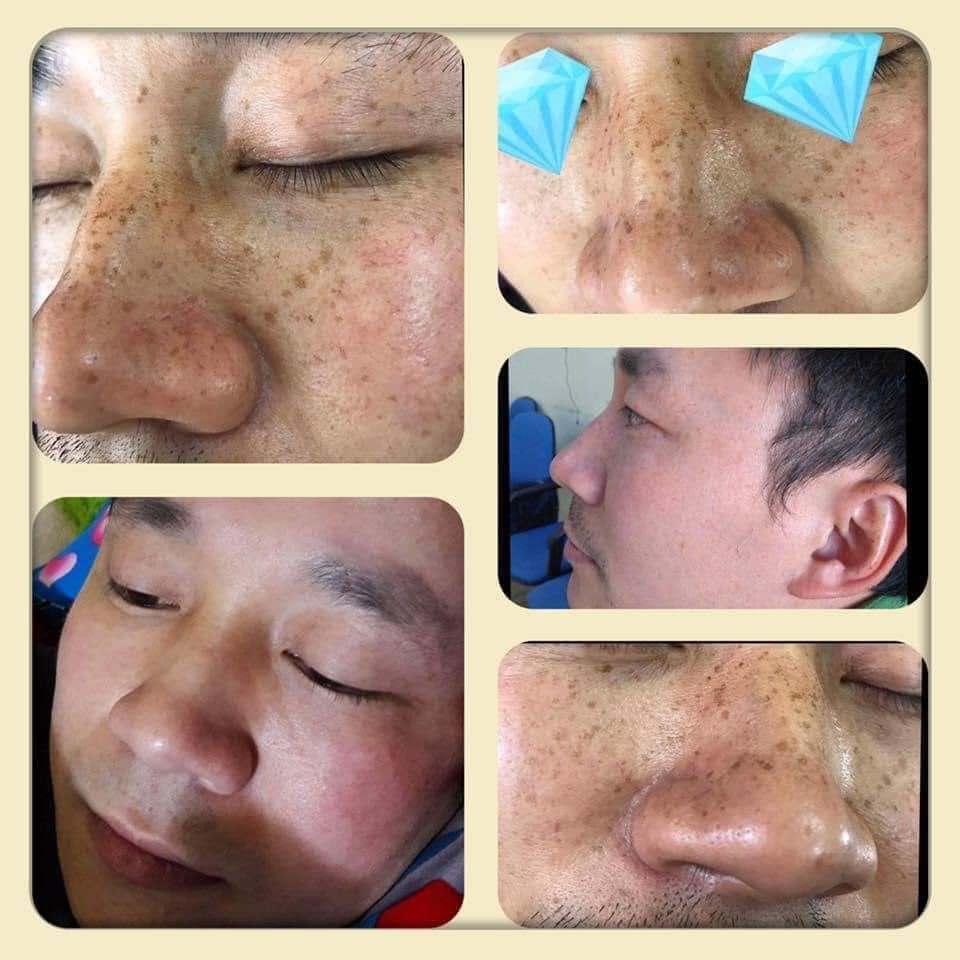 YCANQ1